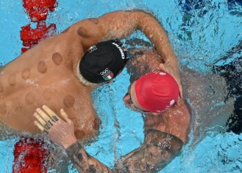 Benefits of Cupping: All About The Circular Marks Spotted on Olympians