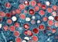 India records first suspected mpox case, male patient in isolation | Health News