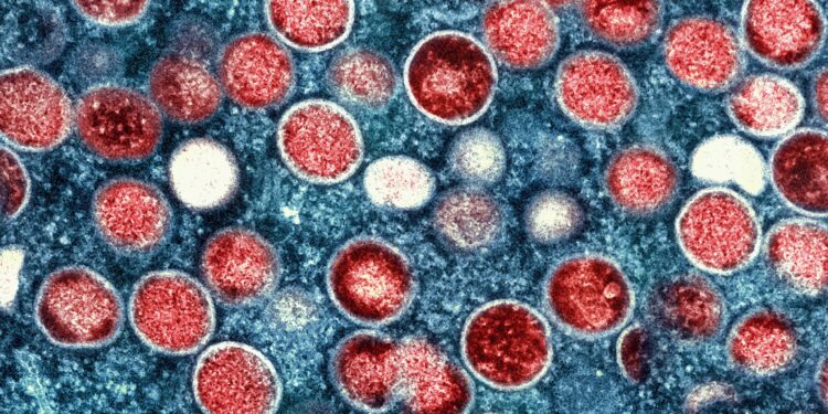 India records first suspected mpox case, male patient in isolation | Health News