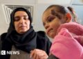 BBC joins Gazan girl, 2, on leg of trip to Jordan for life-saving treatment