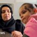 BBC joins Gazan girl, 2, on leg of trip to Jordan for life-saving treatment