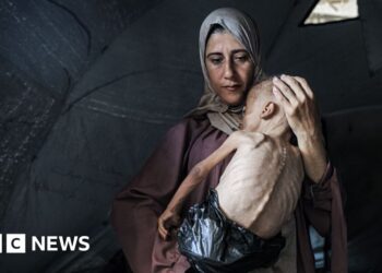 Mother of starving baby speaks to BBC