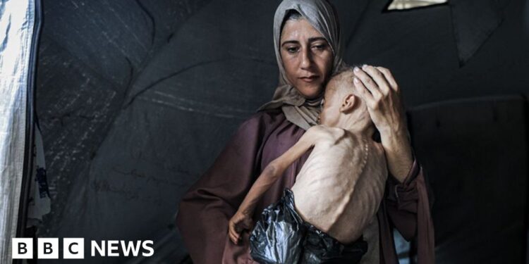 Mother of starving baby speaks to BBC