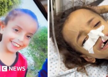 Gaza mother blames famine for halving daughter’s weight