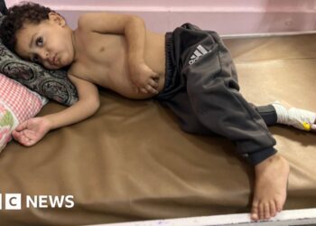 Gaza children dying as they wait for Israel to enable evacuations