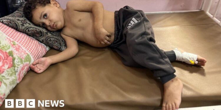 Gaza children dying as they wait for Israel to enable evacuations